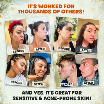 Whipped Beef Tallow & Manuka Honey Balm Face Cream