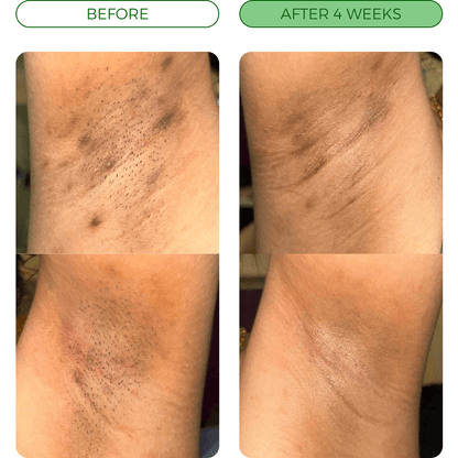 Turmeric Fade & Glow Bar