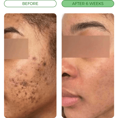 Turmeric Fade & Glow Bar