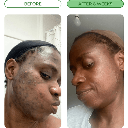 Turmeric Fade & Glow Bar