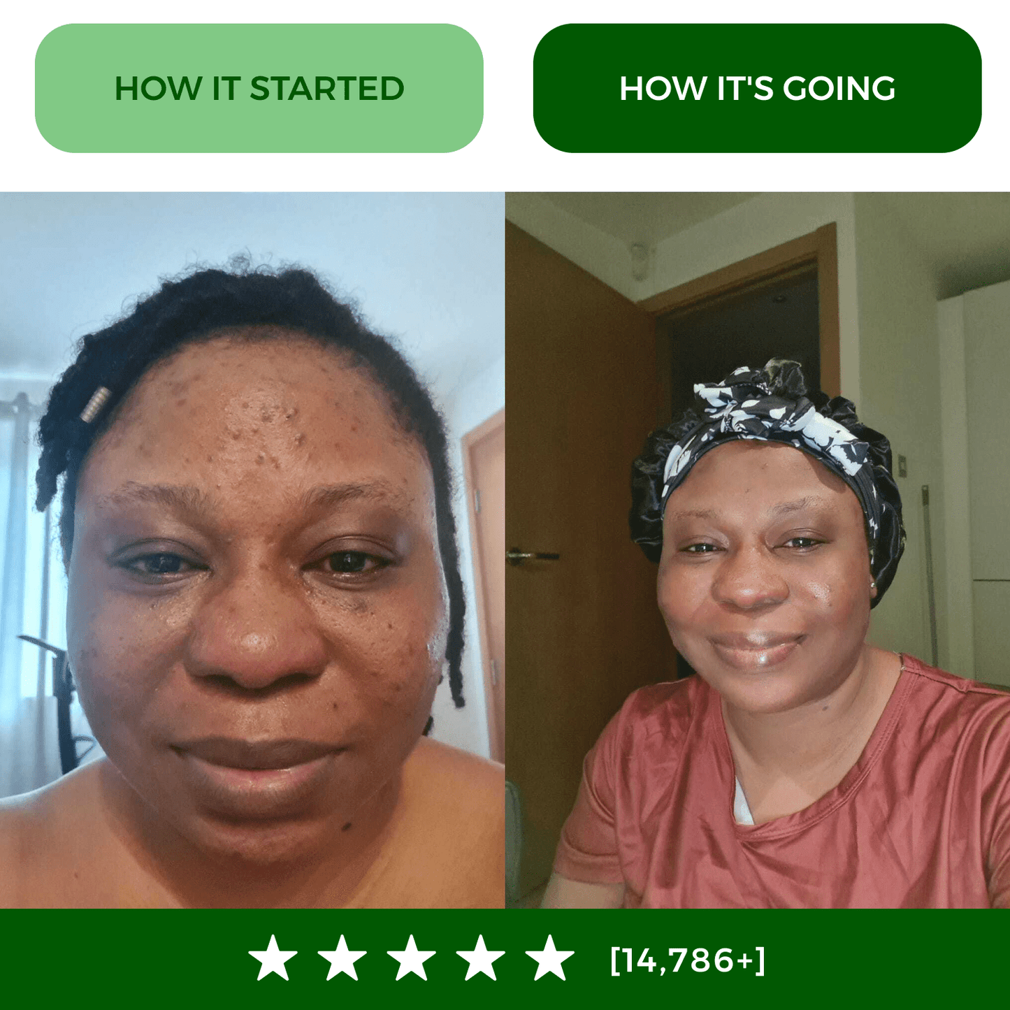 Turmeric Fade & Glow Bar